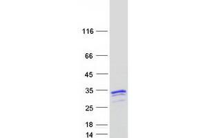 Validation with Western Blot (NAA40 Protein (Myc-DYKDDDDK Tag))