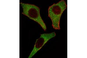 Fluorescent image of Hela cell stained with CDK4 Antibody (C-term) (ABIN391751 and ABIN2841625). (CDK4 抗体  (C-Term))