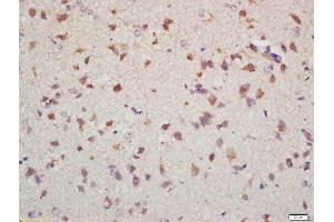 Formalin-fixed and paraffin embedded mouse brain labeled with Anti-NET1 Polyclonal Antibody, Unconjugated (ABIN1714215) at 1:200 followed by conjugation to the secondary antibody and DAB staining (NET1 抗体)