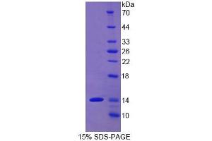 Image no. 1 for CD90 (THY1) (AA 20-133) protein (His tag) (ABIN1099503) (CD90 Protein (THY1) (AA 20-133) (His tag))