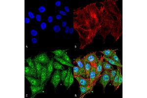 Immunocytochemistry/Immunofluorescence analysis using Rabbit Anti-IGF-1 Polyclonal Antibody . (IGF1 抗体  (FITC))