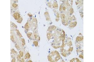 Immunohistochemistry of paraffin-embedded Human stomach using HDAC4 Polyclonal Antibody at dilution of 1:100 (40x lens). (HDAC4 抗体)