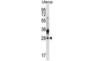 CIB4 Antibody (N-term) western blot analysis in human normal Uterus cell line lysates (35µg/lane). (CIB4 抗体  (N-Term))