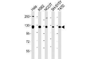 All lanes : Anti-ROR2 Antibody (C-term) at 1:1000-1:2000 dilution Lane 1: Hela whole cell lysate Lane 2: K562 whole cell lysate Lane 3: NCCIT whole cell lysate Lane 4: SH-SY5Y whole cell lysate Lane 5: T47D whole cell lysate Lysates/proteins at 20 μg per lane. (ROR2 抗体  (C-Term))