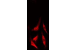ABIN6277509 staining  LOVO cells by IF/ICC. (Cullin 2 抗体  (C-Term))