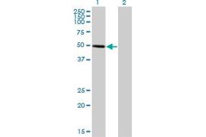 Western Blot analysis of ZNF277 expression in transfected 293T cell line by ZNF277 monoclonal antibody (M01), clone 1B2. (ZNF277 抗体  (AA 1-278))
