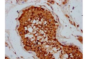 IHC image of ABIN7173536 diluted at 1:400 and staining in paraffin-embedded human testis tissue performed on a Leica BondTM system. (TSEN15 抗体  (AA 1-171))