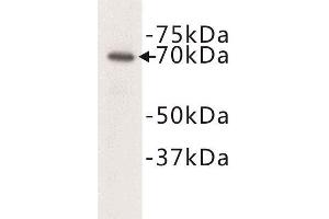 Western Blotting (WB) image for anti-Complement C3 beta Chain (C3b) antibody (ABIN1854871) (Complement C3b 抗体)