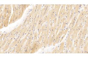 Detection of GATA4 in Human Cardiac Muscle Tissue using Polyclonal Antibody to GATA Binding Protein 4 (GATA4) (GATA4 抗体  (AA 201-442))