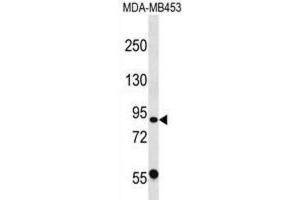 Western Blotting (WB) image for anti-Calpain 13 (CAPN13) antibody (ABIN2998758) (CAPN13 抗体)