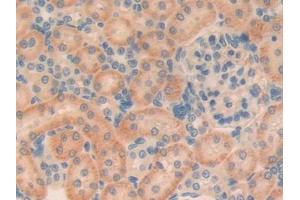 DAB staining on IHC-P; Samples: Rat Kidney Tissue (TGFB1I1 抗体  (AA 256-461))