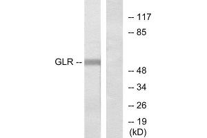 Western Blotting (WB) image for anti-Glycine Receptor, alpha 2 (GLRa2) (Internal Region) antibody (ABIN1852966) (GLRa2 抗体  (Internal Region))