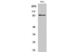 Western Blotting (WB) image for anti-UTP14, U3 Small Nucleolar Ribonucleoprotein, Homolog A (UTP14A) (Internal Region) antibody (ABIN3187442) (UTP14A 抗体  (Internal Region))