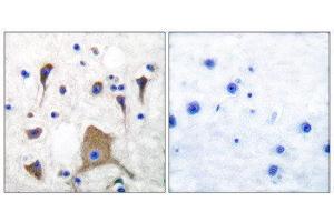 Immunohistochemistry (IHC) image for anti-Glutamate Receptor, Ionotropic, Kainate 1 (GRIK1) (N-Term) antibody (ABIN1848574) (GRIK1 抗体  (N-Term))