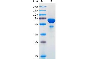 SDS-PAGE (SDS) image for BCL2-Like 1 (BCL2L1) (AA 1-212) protein (Fc Tag) (ABIN7092729)