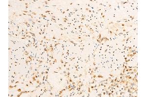 ABIN6267072 at 1/100 staining rat appendiceal tissue sections by IHC-P.