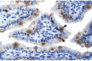 Immunohistochemical staining (Formalin-fixed paraffin-embedded sections) of human lung with MCM6 polyclonal antibody .