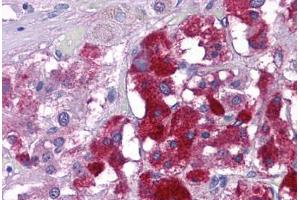 Human Adrenal: Formalin-Fixed, Paraffin-Embedded (FFPE) (KPNA3 抗体  (C-Term))