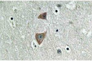 Immunohistochemistry (IHC) analyzes of p70 S6 kinase alpha antibody in paraffin-embedded human brain tissue. (RPS6KB1 抗体)