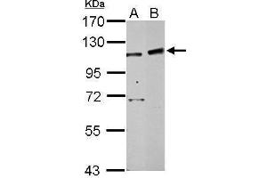 WB Image Sample (30 ug of whole cell lysate) A: 293T B: HepG2 7. (PHF16 抗体  (C-Term))