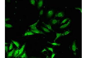 Immunofluorescent analysis of Hela cells using ABIN7146261 at dilution of 1:100 and Alexa Fluor 488-congugated AffiniPure Goat Anti-Rabbit IgG(H+L) (CHP 抗体  (AA 2-195))