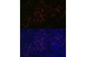 Immunofluorescence analysis of mouse spleen using BTK Rabbit mAb (ABIN7265950) at dilution of 1:100 (40x lens). (BTK 抗体)