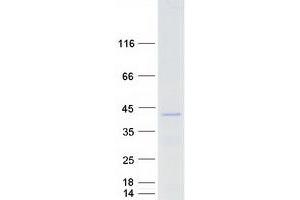 Western Blotting (WB) image for Forkhead Box L1 (FOXL1) protein (Myc-DYKDDDDK Tag) (ABIN2721360)