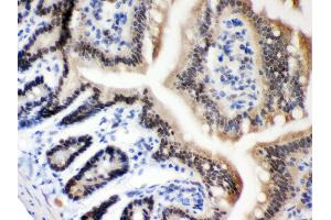 Anti- MSH2 Picoband antibody, IHC(P) IHC(P): Mouse Intestine Tissue (MSH2 抗体  (AA 337-583))