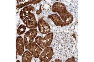Immunohistochemical staining of human kidney with APIP polyclonal antibody  shows cytoplasmic and nuclear positivity in tubular cells. (APIP 抗体)