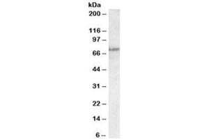 Western blot testing of A431 lysate with TP63 antibody at 0. (p63 抗体)