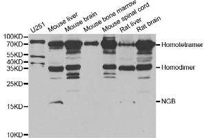 Western blot analysis of extracts of various cell lines, using NGB antibody. (Neuroglobin 抗体)