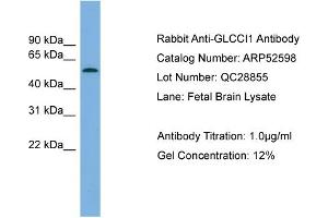 WB Suggested Anti-GLCCI1  Antibody Titration: 0. (GLCCI1 抗体  (Middle Region))