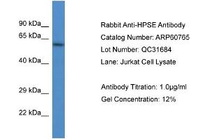 Western Blotting (WB) image for anti-Heparanase (HPSE) (N-Term) antibody (ABIN2788567) (HPSE 抗体  (N-Term))