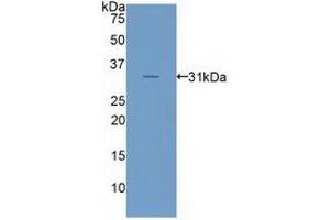 Detection of Recombinant LRP6, Human using Polyclonal Antibody to Low Density Lipoprotein Receptor Related Protein 6 (LRP6) (LRP6 抗体  (AA 981-1213))
