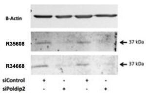 Western blot testing of rat VSMC lysate with POLDIP2 antibody at 0. (POLDIP2 抗体)