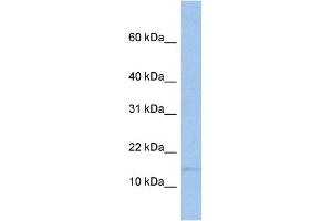 WB Suggested Anti-TRAPPC2 Antibody Titration:  0. (TRAPPC2 抗体  (Middle Region))