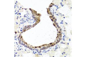 Immunohistochemistry of paraffin-embedded rat lung using TOPBP1 antibody (ABIN6134114, ABIN6149397, ABIN6149400 and ABIN6216254) at dilution of 1:100 (40x lens). (TOPBP1 抗体  (AA 1-100))