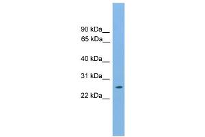 WB Suggested Anti-Hoxb9 Antibody Titration:  0. (HOXB9 抗体  (N-Term))