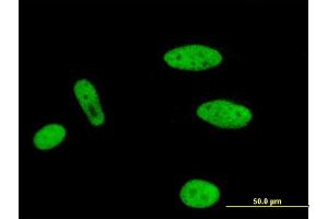 Immunofluorescence of monoclonal antibody to MLLT1 on HeLa cell. (MLLT1 抗体  (AA 472-559))