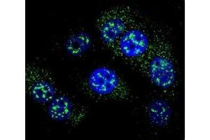 Immunofluorescence (IF) image for anti-O6-Methylguanine-DNA-Methyltransferase (MGMT) (AA 1-30) antibody (ABIN3032084)