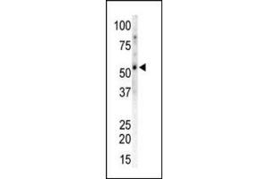 Western blot of CAMK2G / CAMKG Antibody to detect CAMK2 gamma in Mouse heart tissue lysate. (CAMKII gamma 抗体  (C-Term))