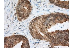 Immunohistochemical staining of paraffin-embedded Human liver tissue using anti-ACAT2 mouse monoclonal antibody. (ACAT2 抗体)