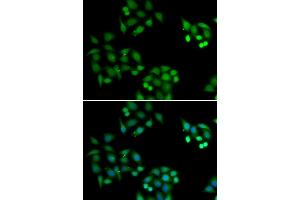 Immunofluorescence analysis of HeLa cells using NSFL1C antibody (ABIN6131003, ABIN6144873, ABIN6144874 and ABIN6222382). (NSFL1C 抗体  (AA 1-185))