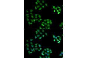 Immunofluorescence analysis of HeLa cells using NSFL1C antibody (ABIN6131003, ABIN6144873, ABIN6144874 and ABIN6222382). (NSFL1C 抗体  (AA 1-185))