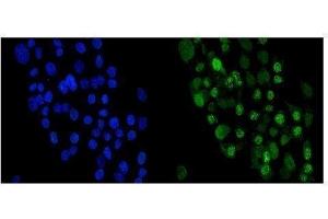 IF analysis of Periplakin using anti-Periplakin antibody (ABIN5518787).