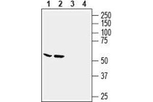 Western blot analysis of human MCF-7 breast adenocarcinoma cell line (lanes 1 and 3) and human LNCaP prostate adenocarcinoma cell line (lanes 2 and 4) lysates: - 1,2. (Slc6a14 抗体  (2nd Extracellular Loop))