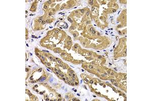 Immunohistochemistry of paraffin-embedded human kidney using WBSCR22 antibody (ABIN4905616) at dilution of 1:100 (40x lens). (WBSCR22 抗体)