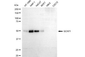 Western blotting analysis using GCNT1 antibody (ABIN7798732).