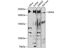 Western blot analysis of extracts of various cell lines, using SMG6 antibody (ABIN6133311, ABIN6148132, ABIN6148133 and ABIN6214288) at 1:1000 dilution. (SMG6 抗体  (AA 1160-1419))
