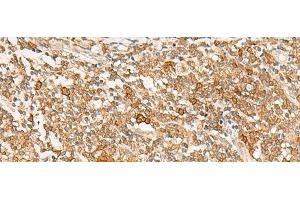 Immunohistochemistry of paraffin-embedded Human tonsil tissue using JPT1 Polyclonal Antibody at dilution of 1:35(x200) (JPT1 抗体)